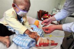 “白血病”兒童增加，甲醛危害值得關(guān)注